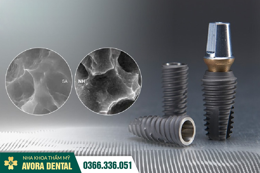 Top 3 Dòng Trụ Implant Mỹ Tốt Được Các Chuyên Gia Khuyên Dùng