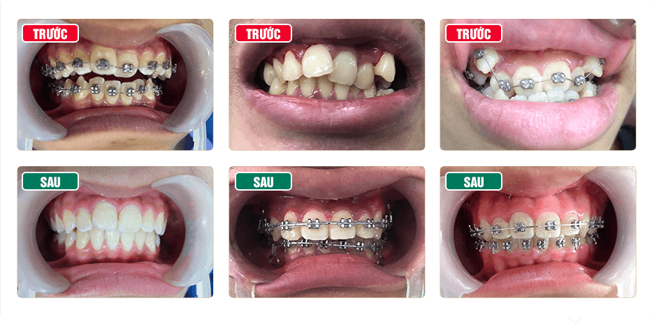 Nha Khoa AVORA Dental